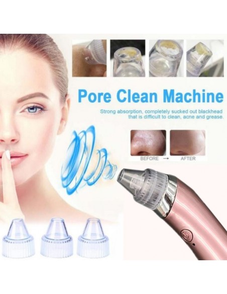 LIMPADOR FACIAL A VÁCUO PONTOS NEGROS TRATAMENTOS DE ROSTO