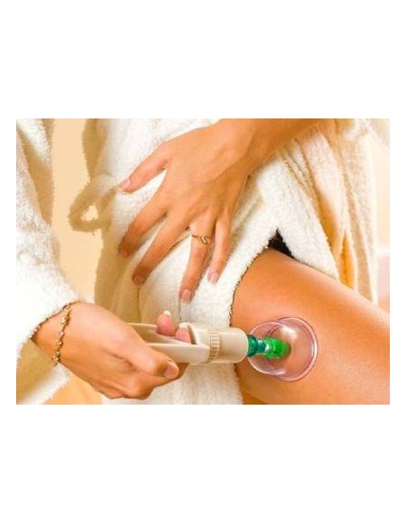 VENTOSATERAPIA 12 COPOS DE VÁCUO COM BOMBA MAQUINAS DE VÁCUOTERAPIA