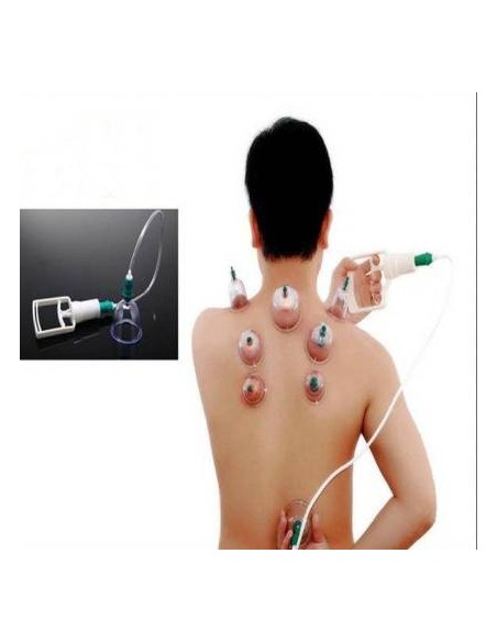 VENTOSATERAPIA 12 COPOS DE VÁCUO COM BOMBA MAQUINAS DE VÁCUOTERAPIA