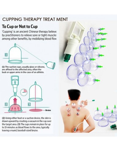 VENTOSATERAPIA 12 COPOS DE VÁCUO COM BOMBA MAQUINAS DE VÁCUOTERAPIA