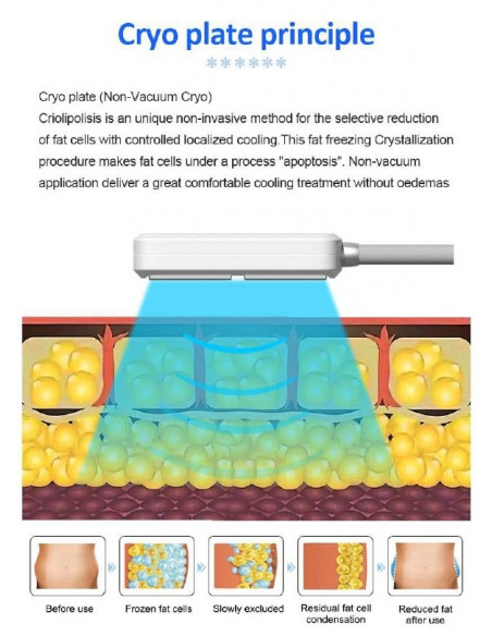 MAQUINA DE CRIOLIPOLISE DE PLACAS + EMS MAQUINAS DE CRIOLIPÓLISE