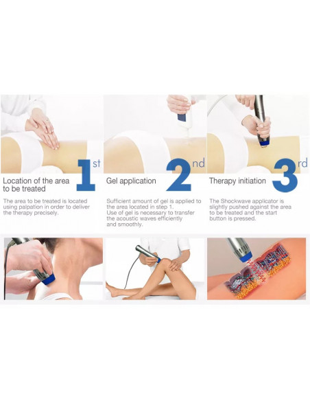 MAQUINA SHOCKWAVE TERAPIA ONDAS DE CHOQUE ESTECTICA E BEM ESTAR