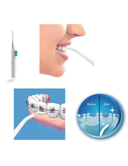 IRRIGADOR DENTAL ORAL MANUAL HIGIENE ORAL