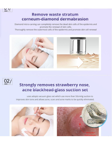 APARELHO MICRODERMOABRASÃO VACUO MAQUINAS MICRODERMOABRASÃO